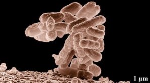 Bakterie E-coli