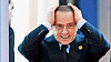Silvio Berlusconi kv�li sv� ple�i podstoupil transplantaci vlas�