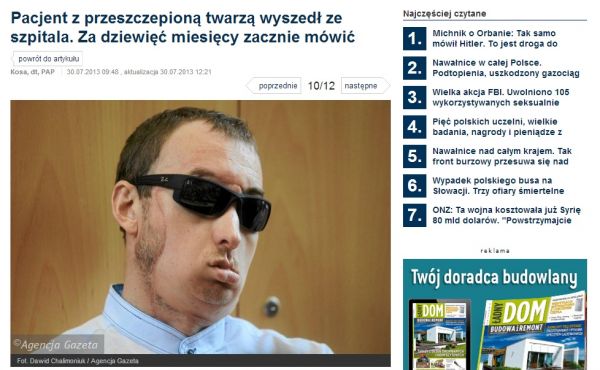 Webov strnka gazeta.pl s fotografiemi Polka s transplantovanou tv