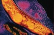 bakterie Mycobacterium tuberculosis