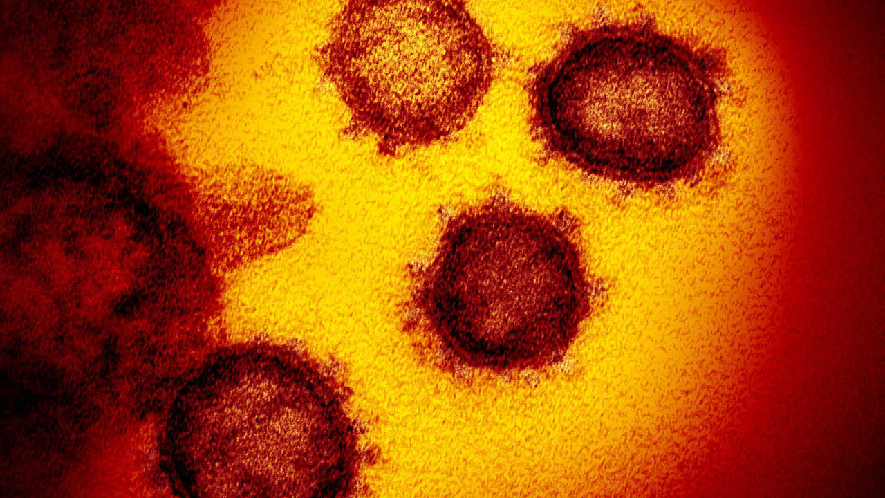 Snímek nového koronaviru