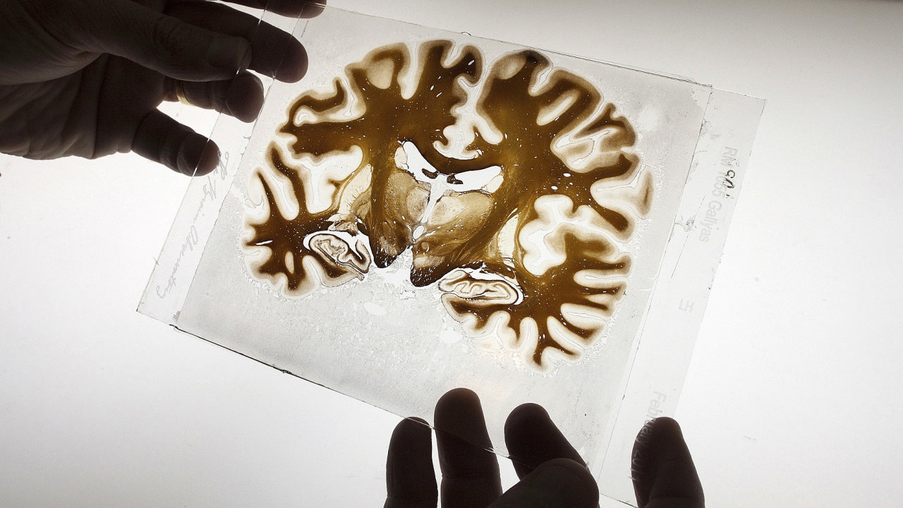 Lidsk mozek - Ilustran foto.