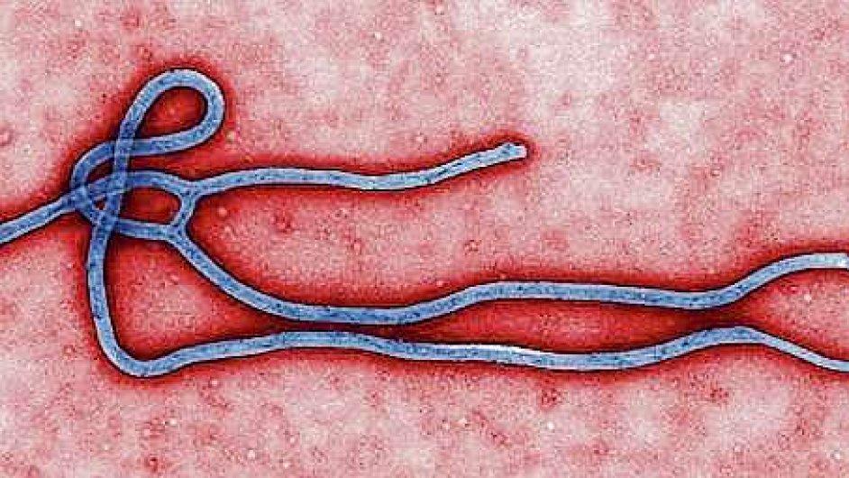 Smrtelný virus ebola
