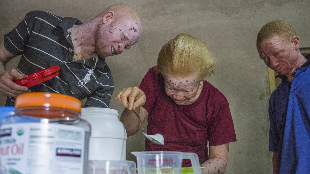 Skupina afrických albínù vyrábí opalovací krém podle èeské receptury. Tu vymysleli èeští vìdci tak, aby obsahovala levné výrobní suroviny a zvládli ji i laici.
