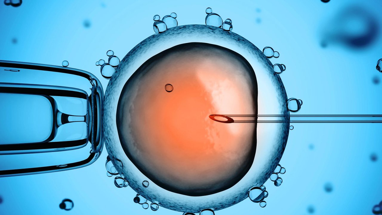 Nejastj metoda asistovan reprodukce je IVF, in vitro fertilizace (oplodnn 