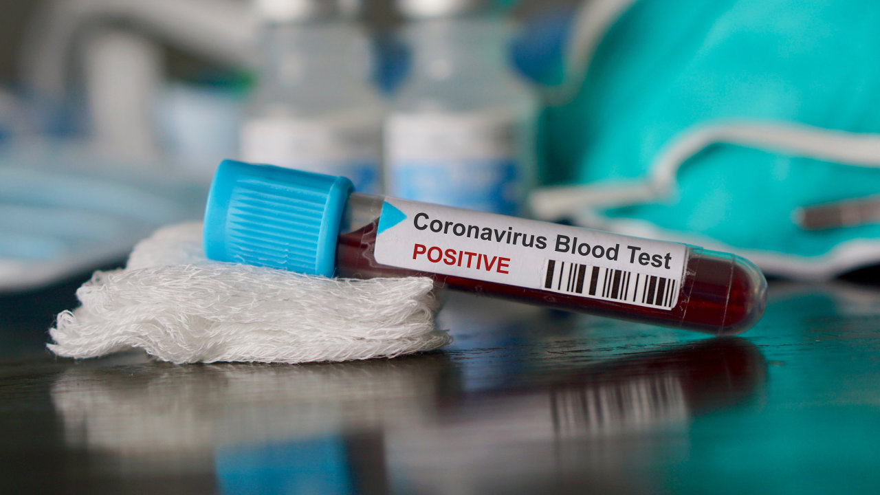 K prvnmu mrt na koronavirus mimo nu dolo na Filipnch.