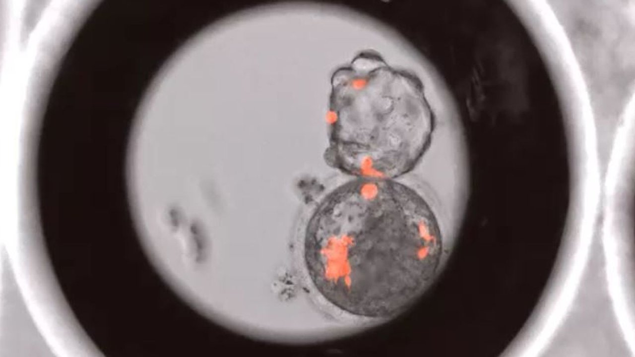 Lidsk kmenov buky vdci nechali vopich embrych rst 19 dn, pak je zniili. Podle nich ale pokus dokzal, e podobn je mon pstovat orgny potebn ktransplantaci.