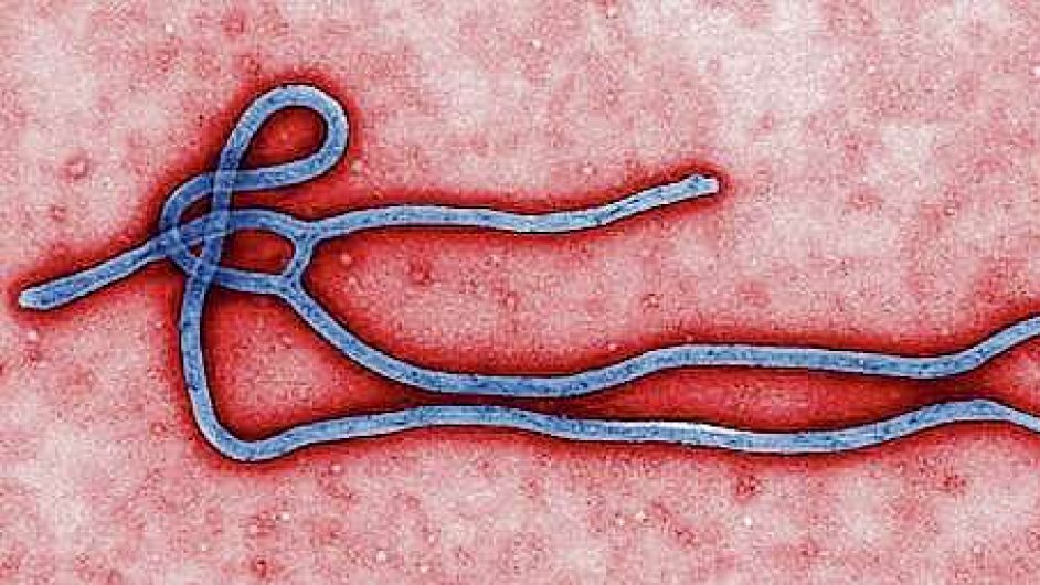 Smrtelný virus ebola