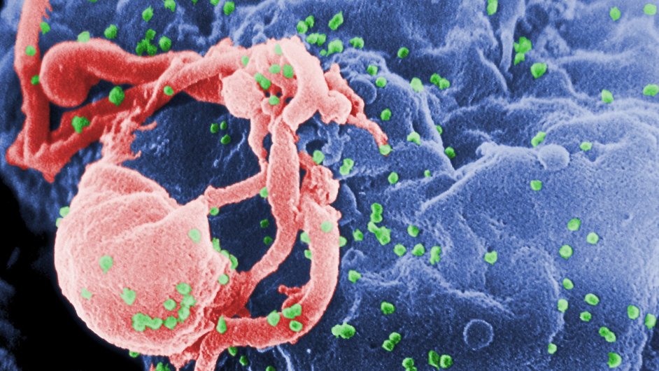 Virus HIV, ilustran foto.