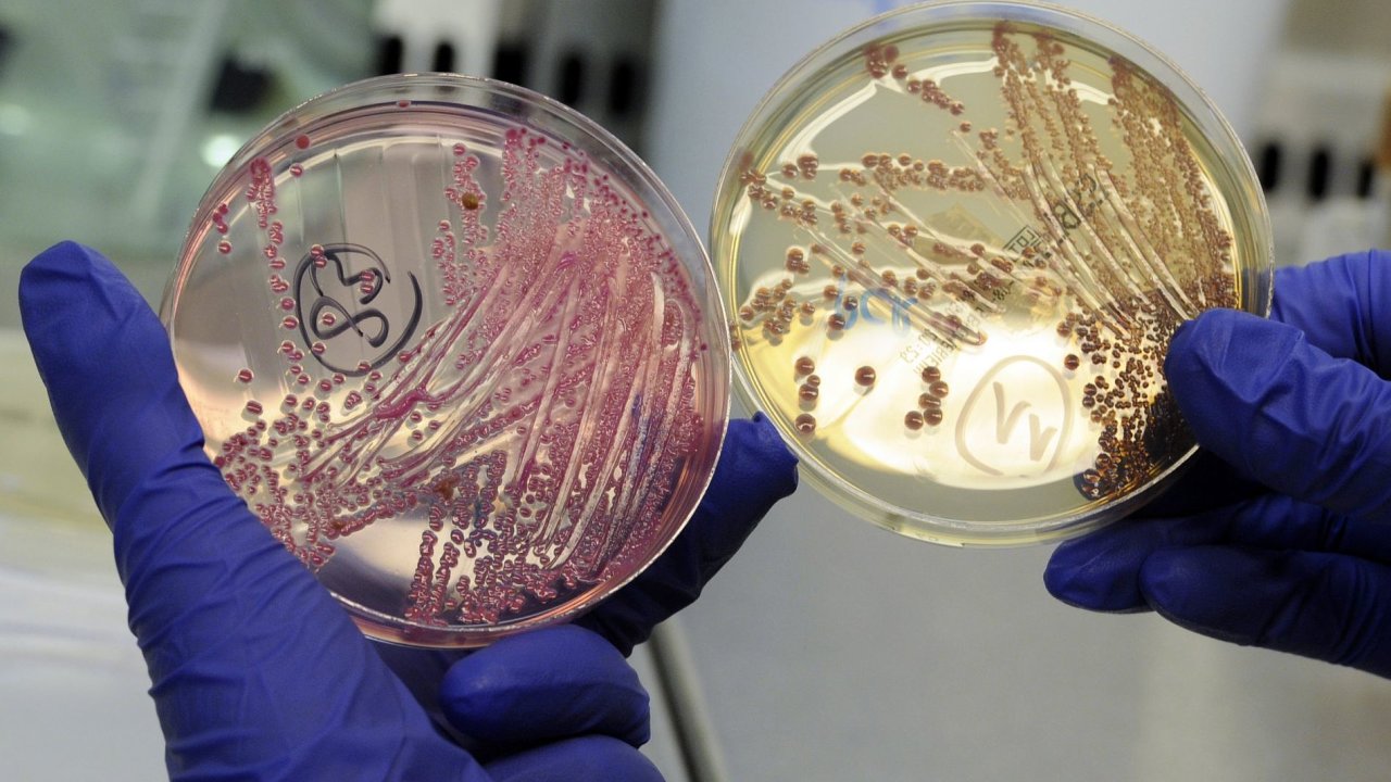 Vzorky bakterie E.coli