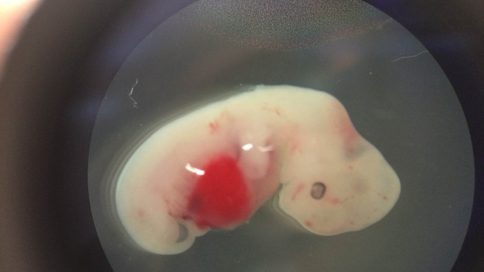 Budoucnost vìdy? Ètyøtýdenní praseèí embryo, které má pøidáné lidské kmenové buòky.