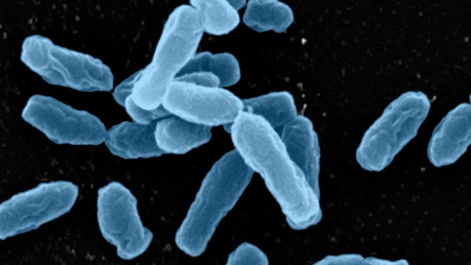 Orchobacterium, jeden z pdnch druh obsahujcch geny pro odolnost vi antibiotikm. Foto: Washington University.