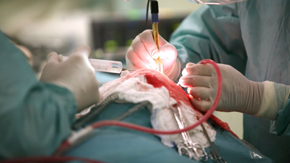 Operace na neurochirurgick� klinice.