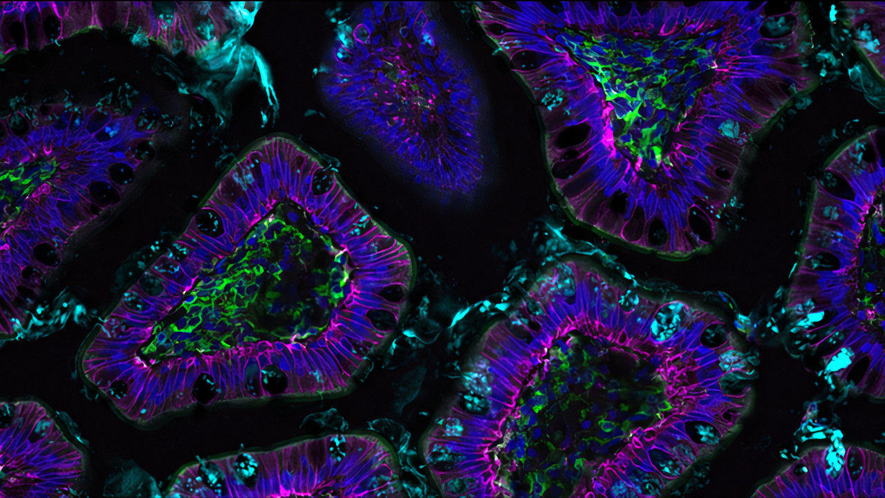 Nový typ imunitních bunìk by jednou možná šlo využívat i v boji proti støevním zánìtùm, jako je napøíklad Crohnova choroba. Ilustraèní mikroskopický snímek zobrazuje buòky myšího støeva.