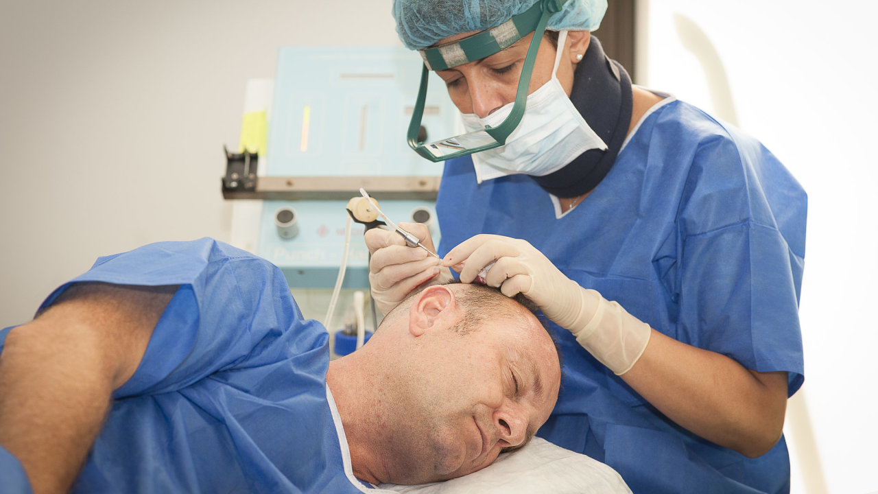 Transplantaci vlasù si lze pøedstavit jako pøesazování kvìtin. Chirurg pøesazuje vlasy z týlu hlavy, kde nejèastìji nevypadávají, na pøední èást, kde jsou kouty nebo pleš.