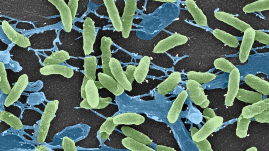 Pseudomonas aeruginosa, pdn bakterie, kter m i patogenn kmeny. Foto: Washington University.