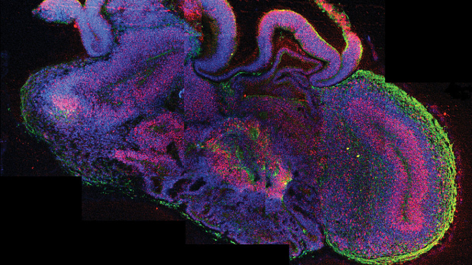 tvar vypstovan z lidskch kmenovch bunk mnoha detaily pipomn embryonln mozek.